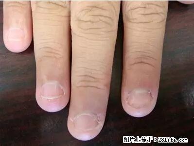 剪指甲、挖耳屎，这些日常小动作竟隐藏大危害！ - 吉安生活资讯 - 吉安28生活网 ja.28life.net